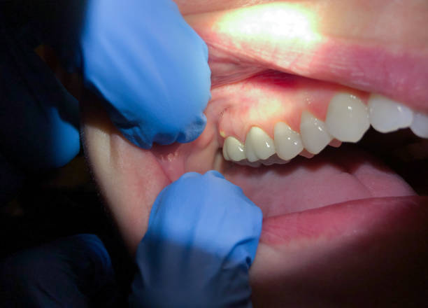 Best Broken or Chipped Tooth Repair in Tybee Island, GA