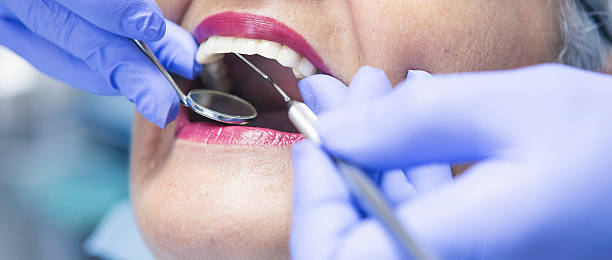 Trusted GA Emergency Dental Service Experts